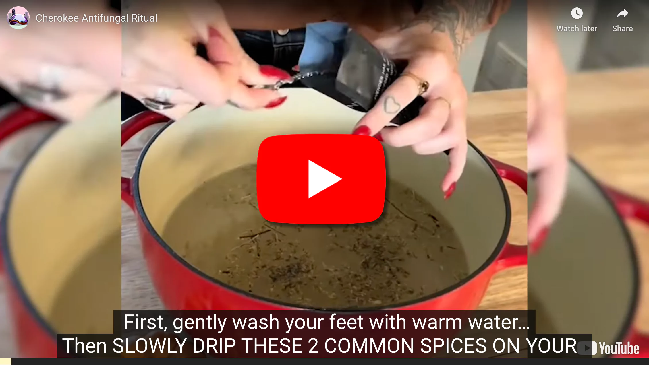 home remedies for toenail fungus
